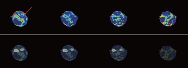 MRI(1T)СӋ
